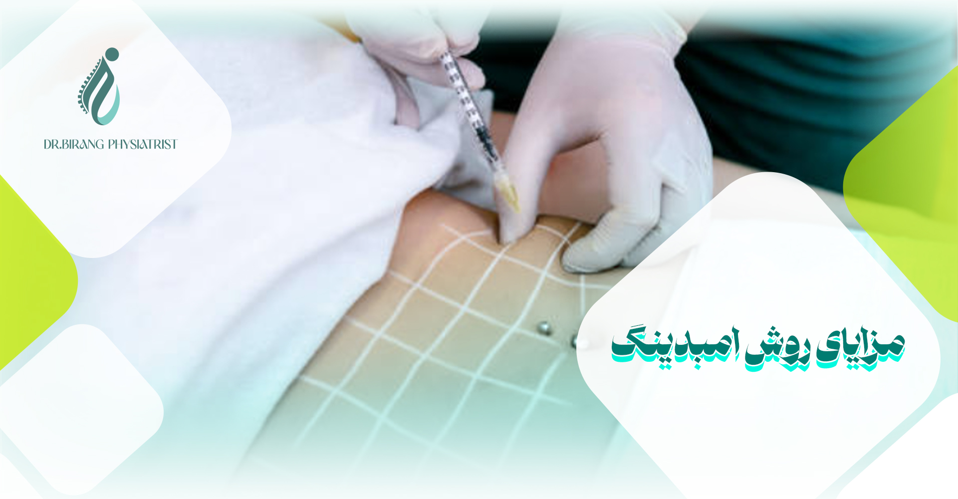 مزایای روش امبدینگ