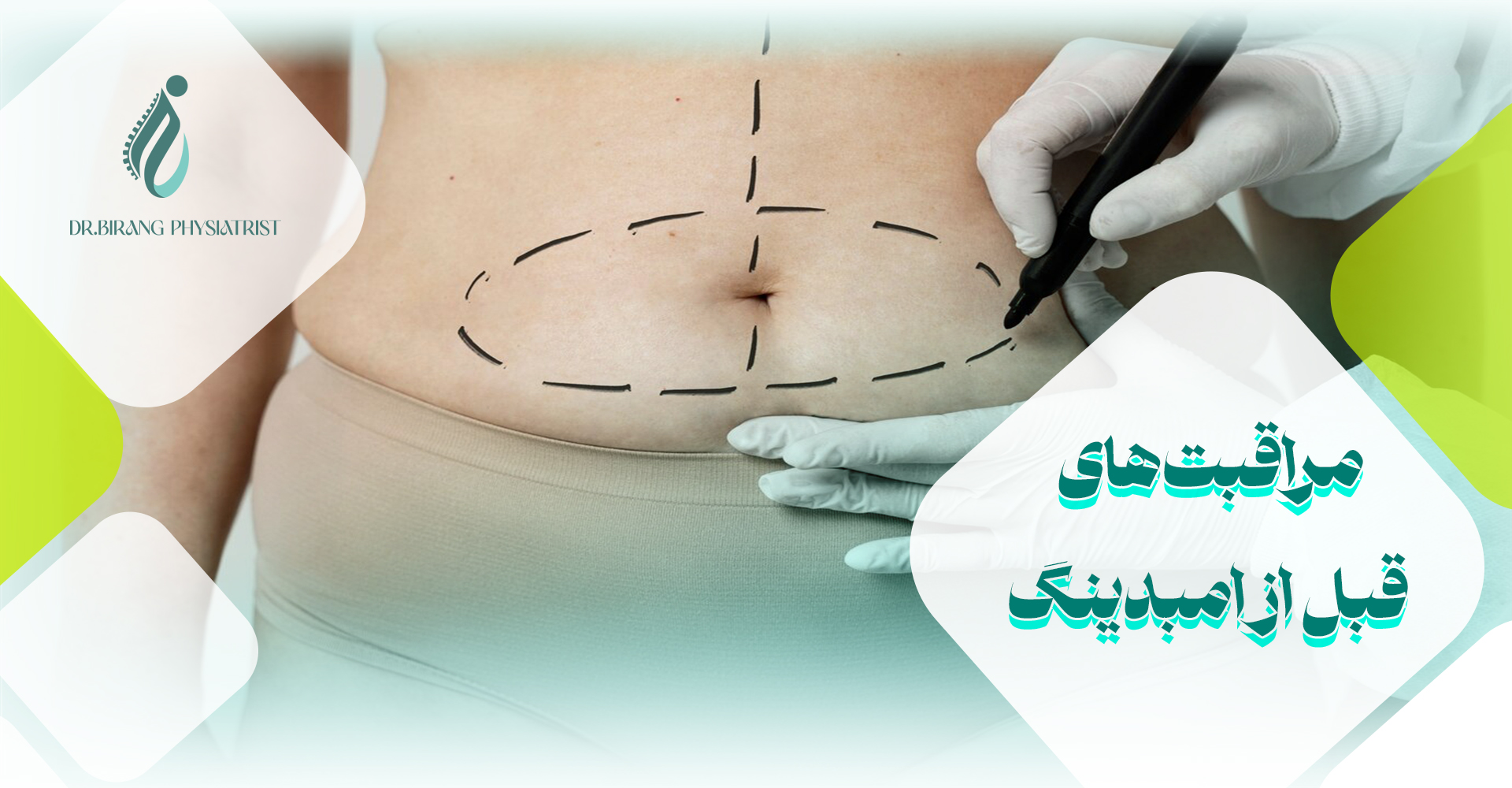 مراقبتهای قبل از امبدینگ
