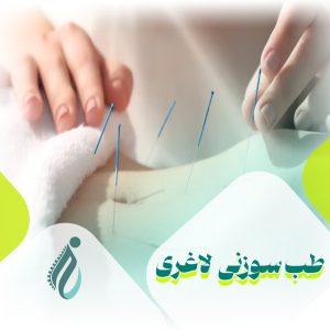 طب سوزنی برای لاغری