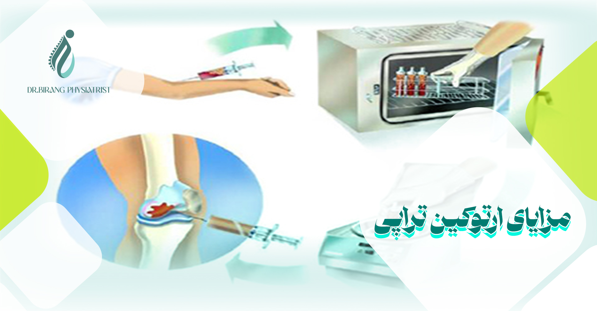 مزایای ارتوکین تراپی