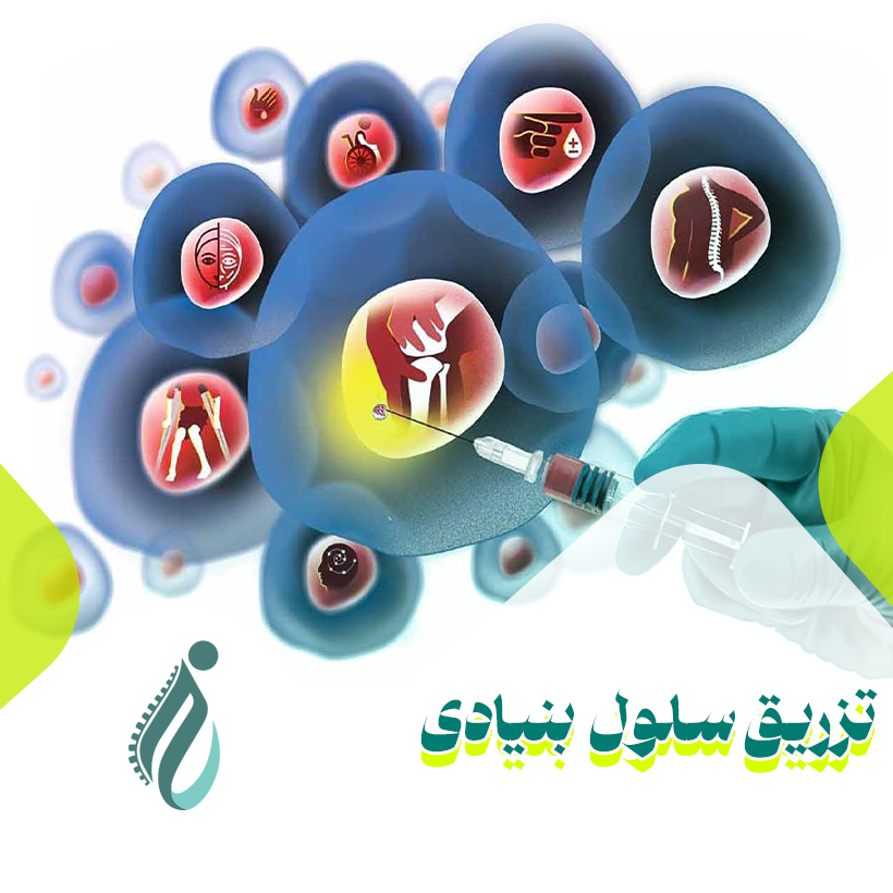 تزریق سلول های بنیادی