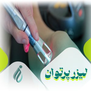 لیزر پرتوان