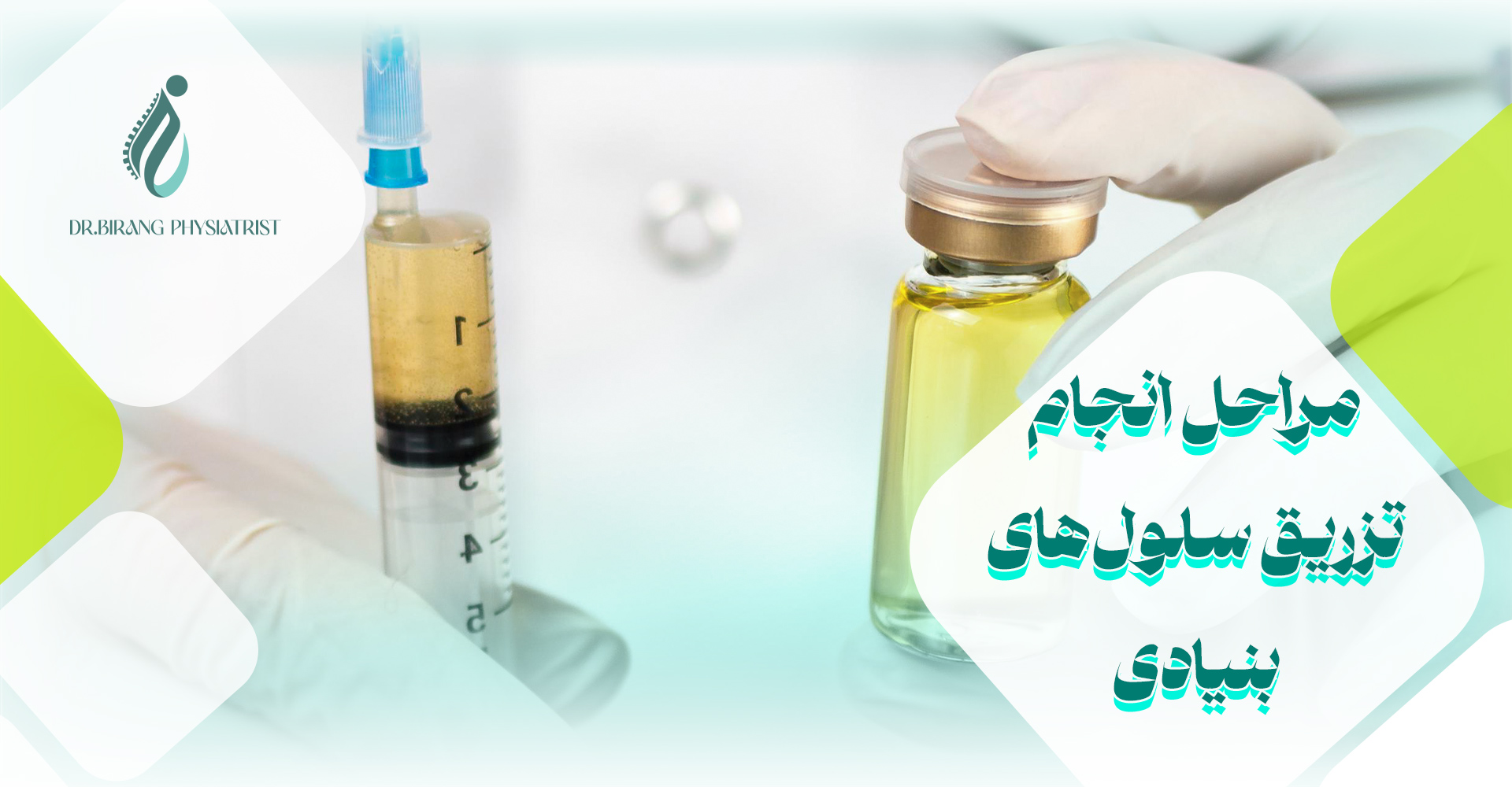 مراحل انجام تزریق سلول های بنیادی