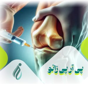 پی آر پی زانو