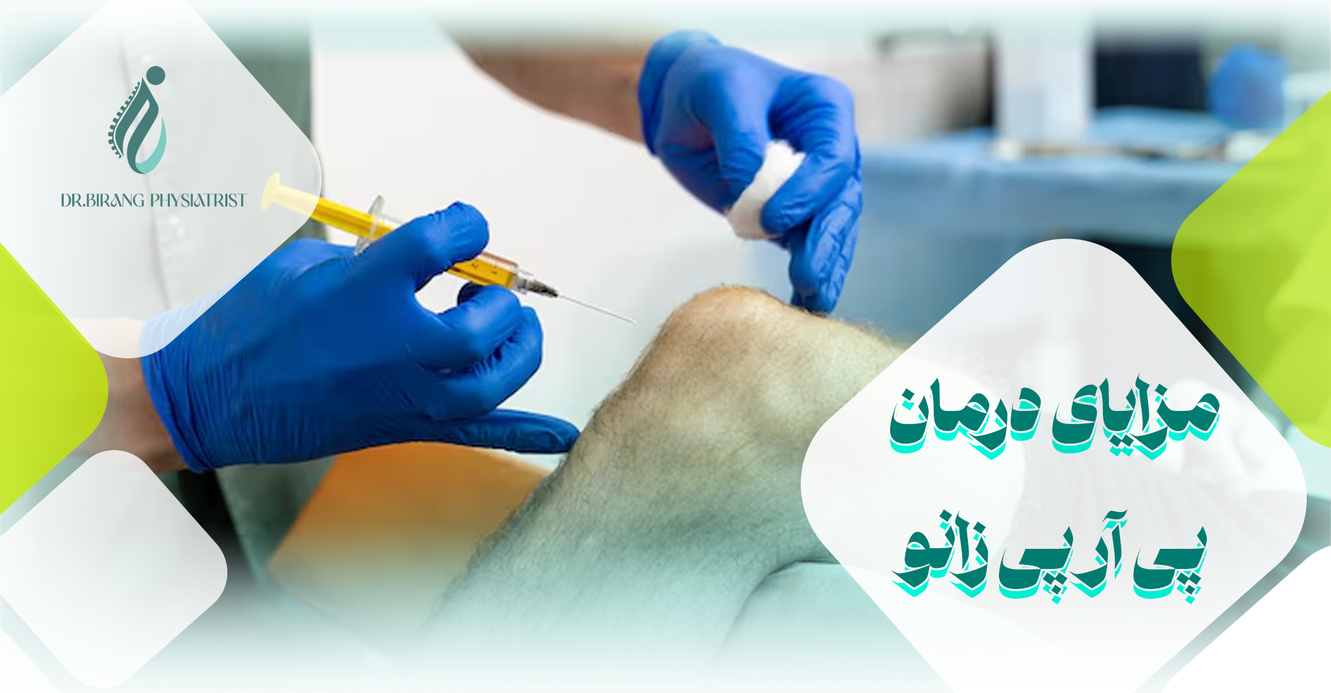 مزایای درمان پی آر پی زانو
