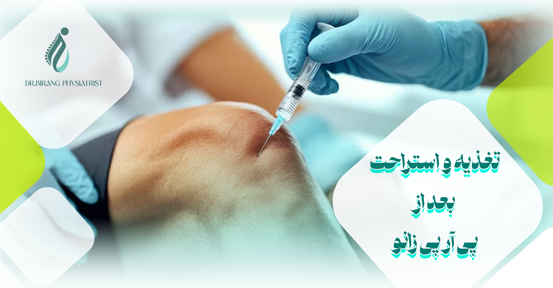 تغذیه و استراحت بعد از پی آر پی زانو