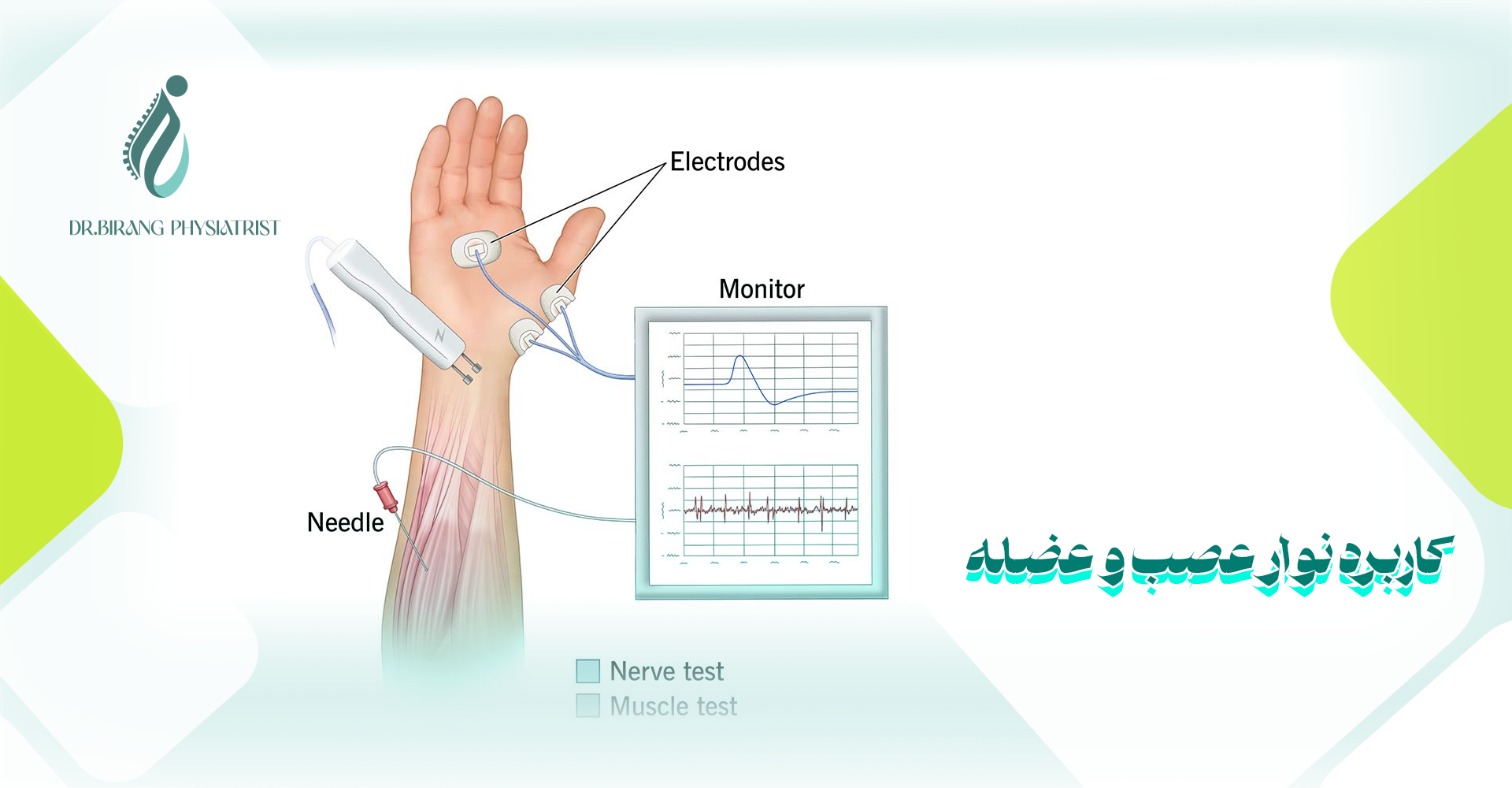 کاربرد نوار عصب و عضله