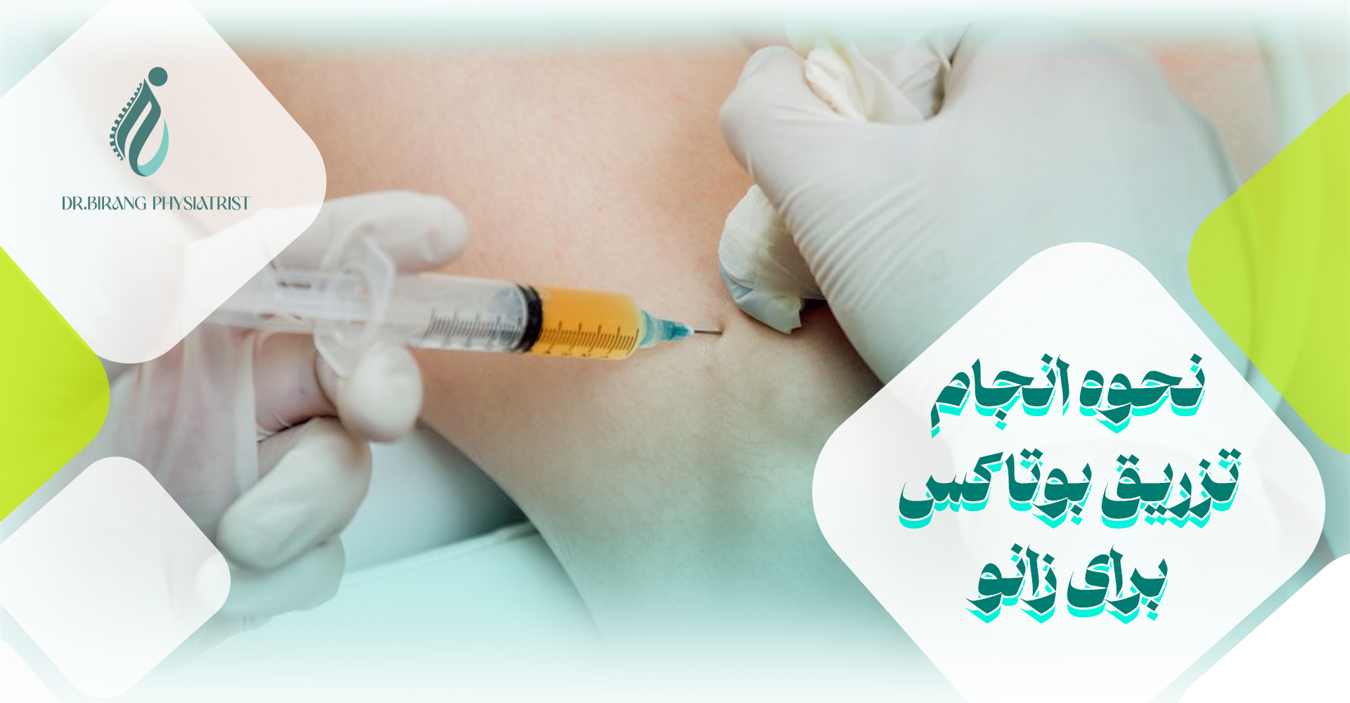 نحوه انجام تزریق بوتاکس برای زانو