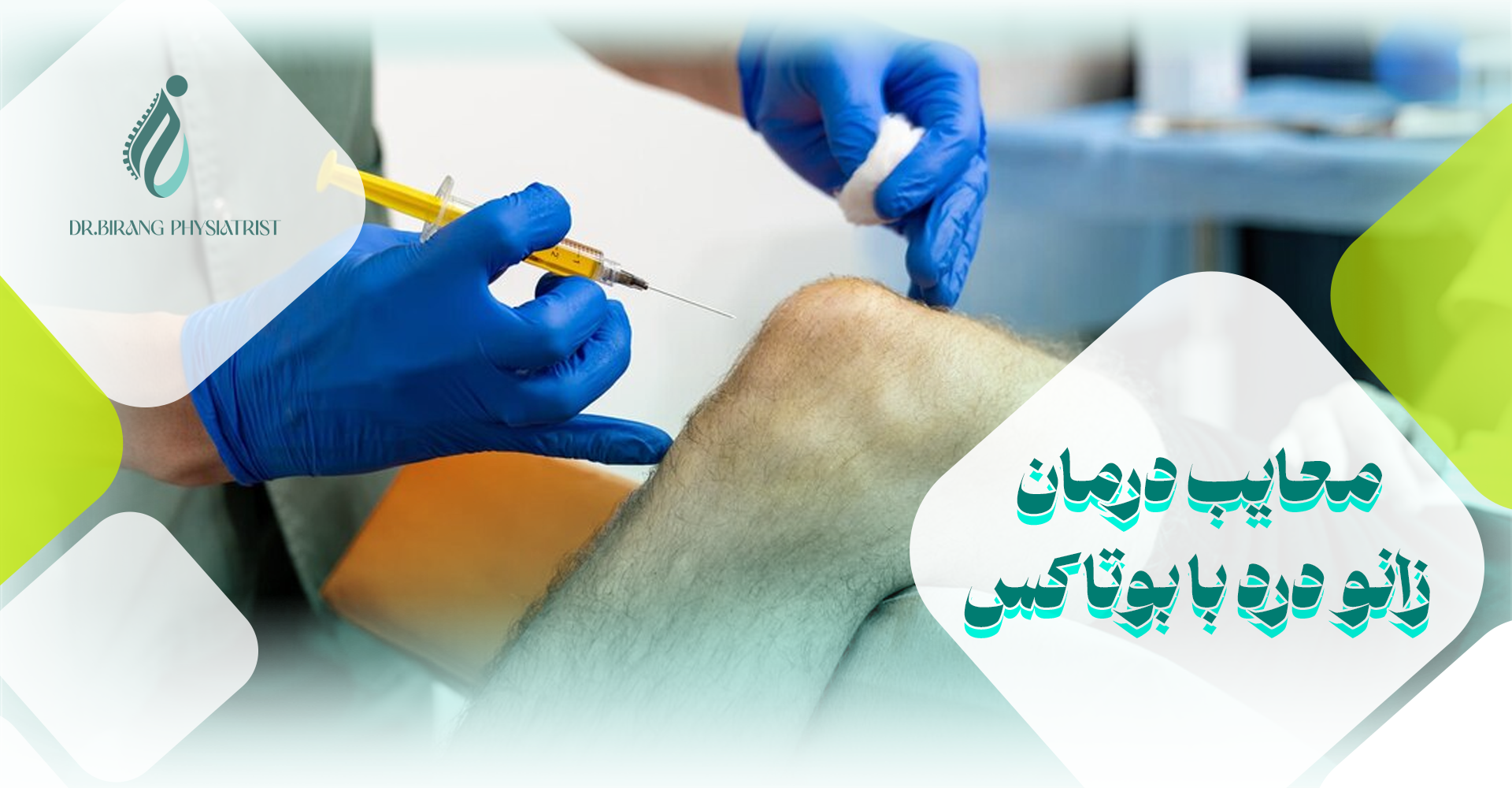 معایب درمان زانو درد با بوتاکس