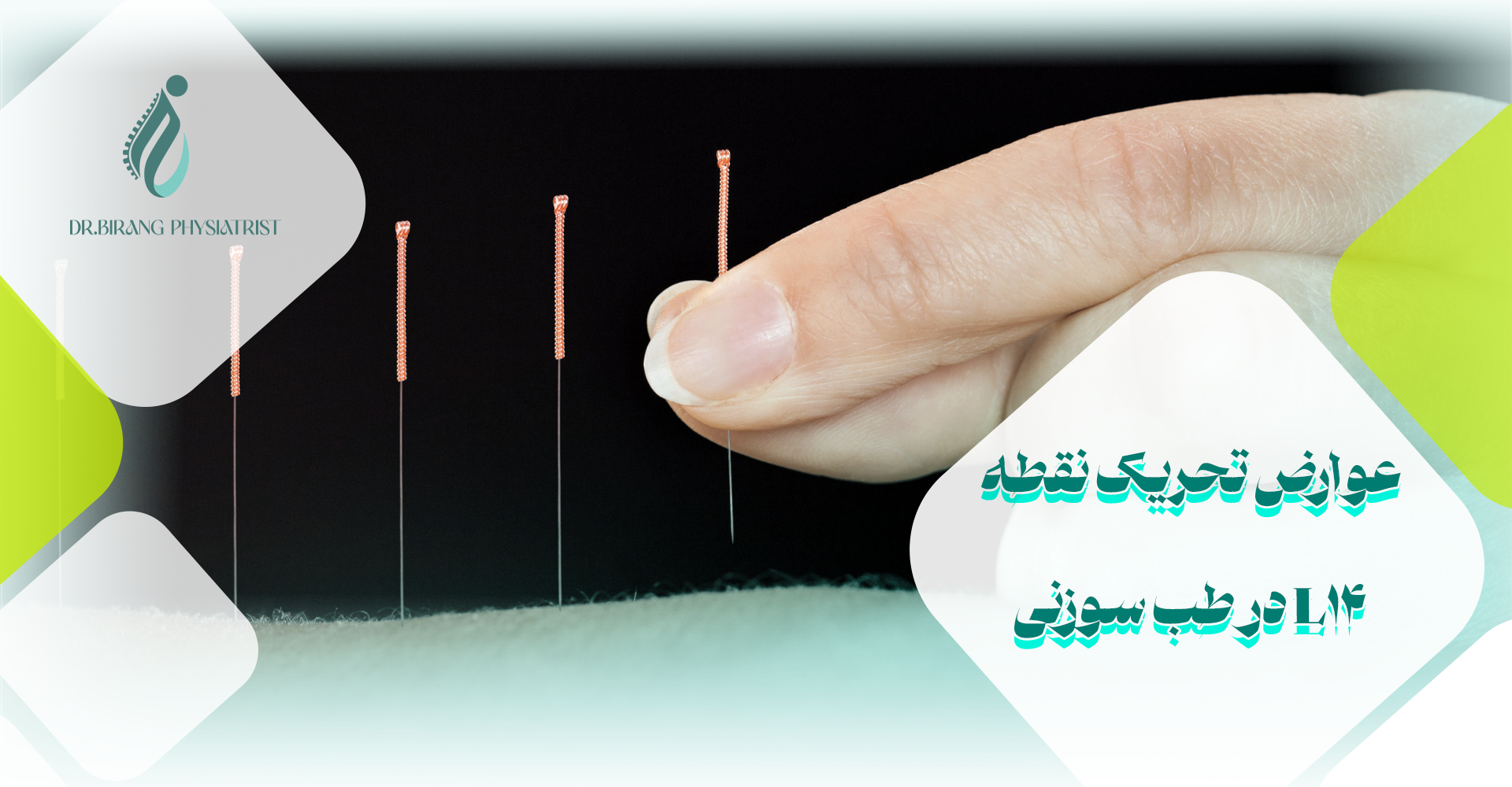 عوارض تحریک نقطه L14 در طب سوزنی