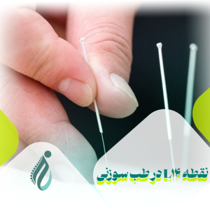 نقطه L14 در طب سوزنی