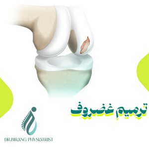 بهترین روش برای ترمیم غضروف