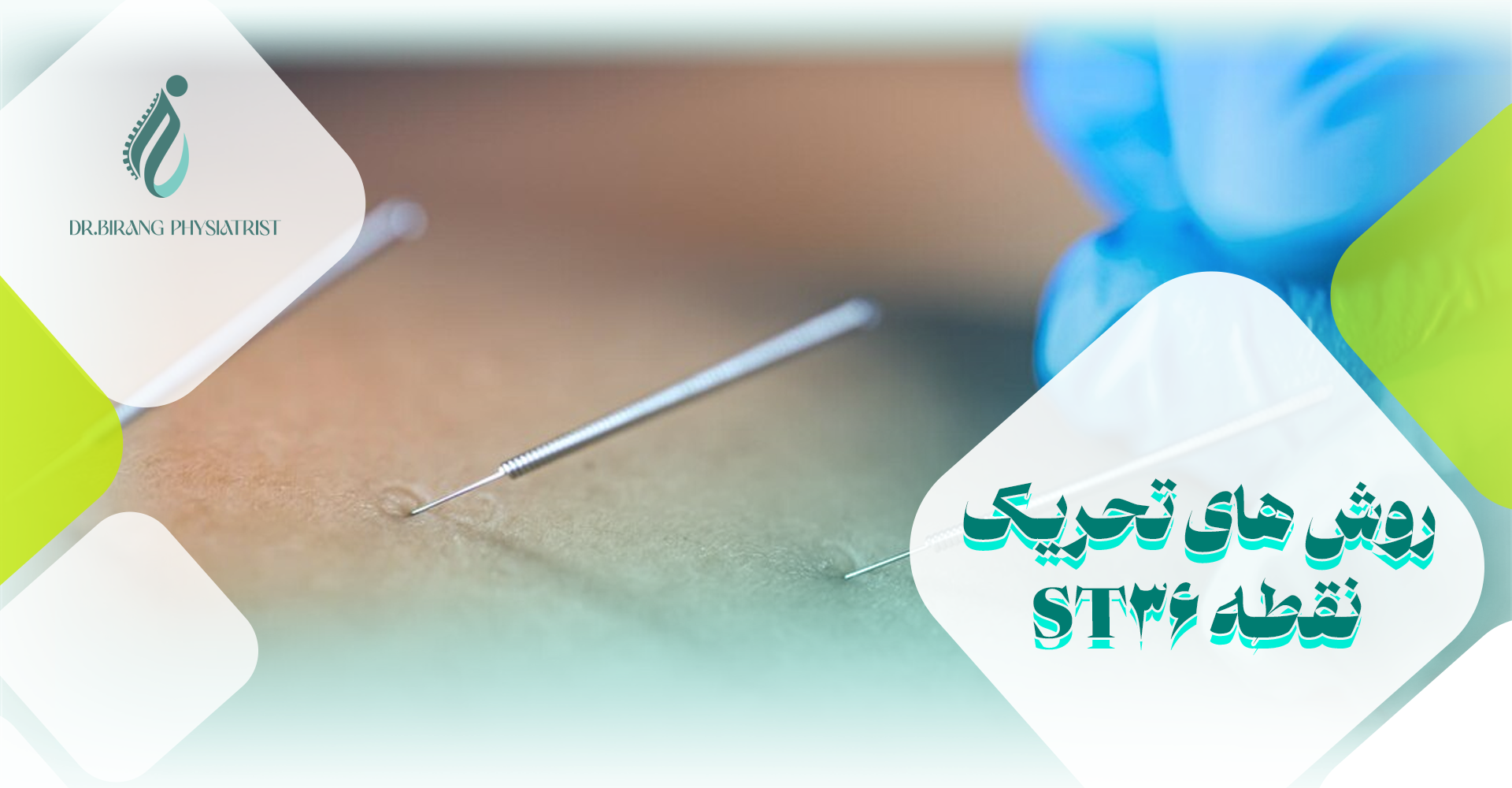روش های تحریک نقطه ST36
