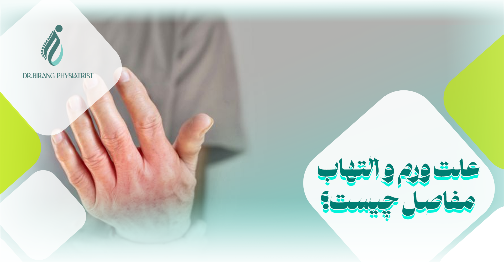 علت ورم و التهاب مفاصل چیست؟
