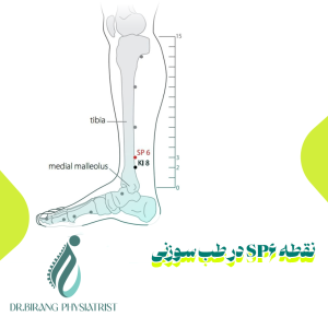 نقطه SP6 در طب سوزنی
