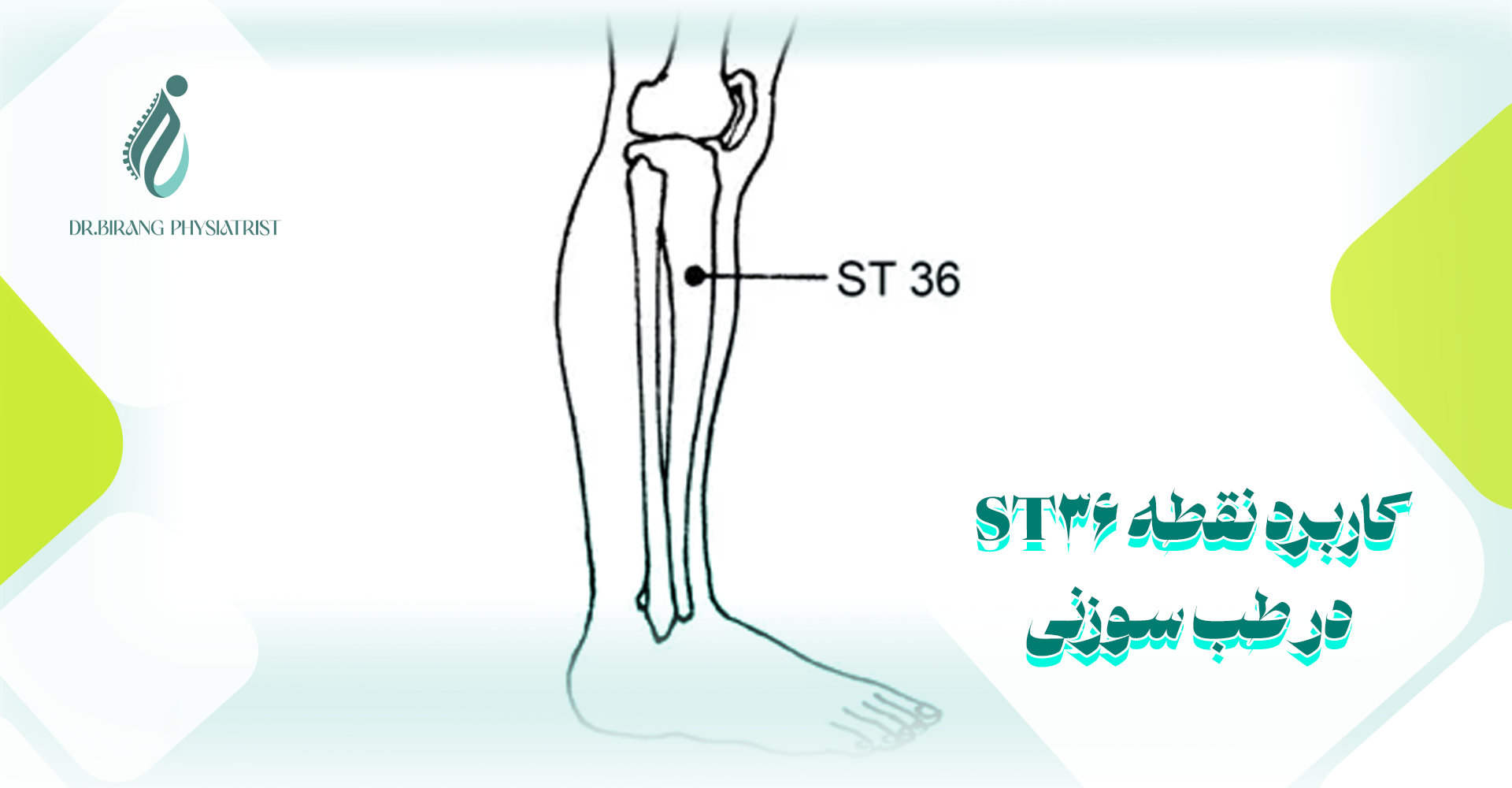 کاربرد نقطه ST36 در طب سوزنی