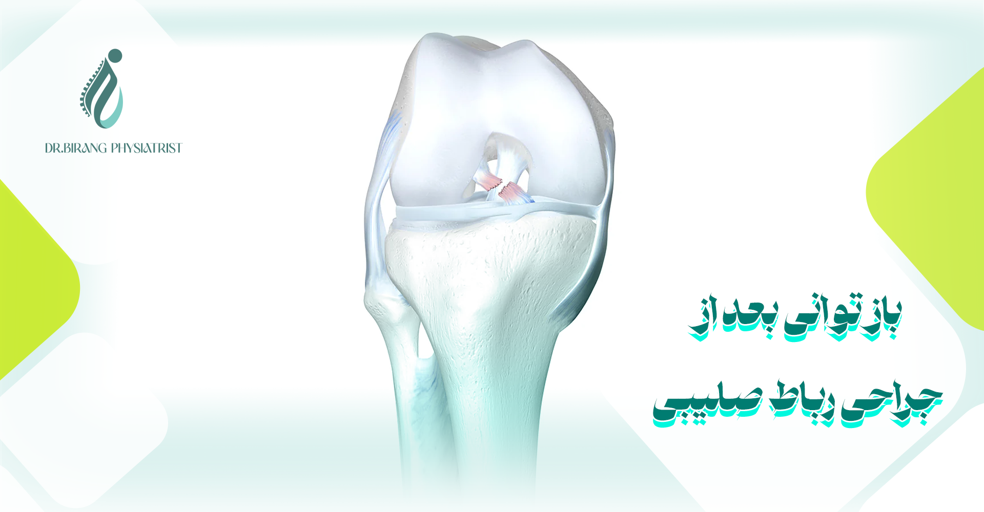 باز توانی بعد از جراحی رباط صلیبی