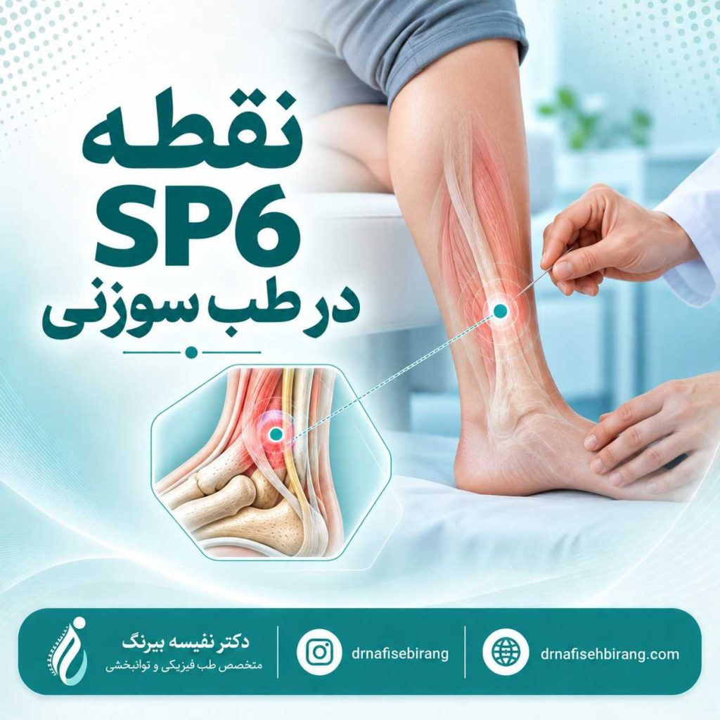 نقطه SP6 در طب سوزنی