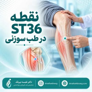 نقطه ST36 در طب سوزنی