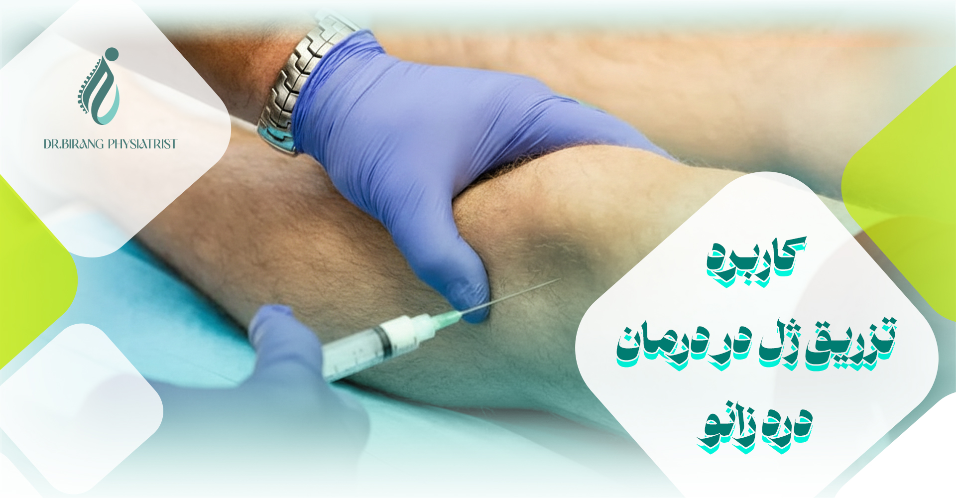 کاربرد تزریق ژل در درمان درد زانو
