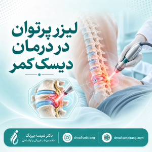 لیزر پرتوان در درمان دیسک کمر