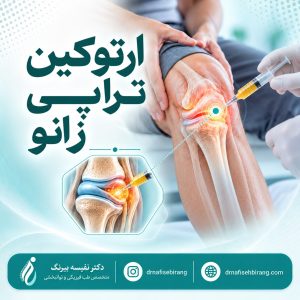 ارتوکین تراپی زانو